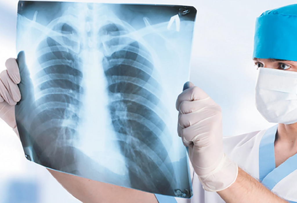 Курсы переподготовки и повышения квалификации по специальности Рентгенология для рентгенологов